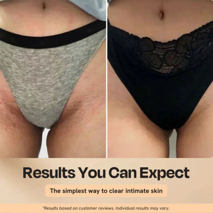 Peel Shot Keratin Care Kojic Acid Turmeric Spray