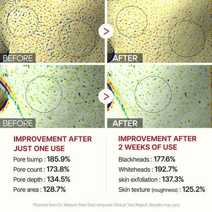 Peel Shot Glow Black Rice Ampoule