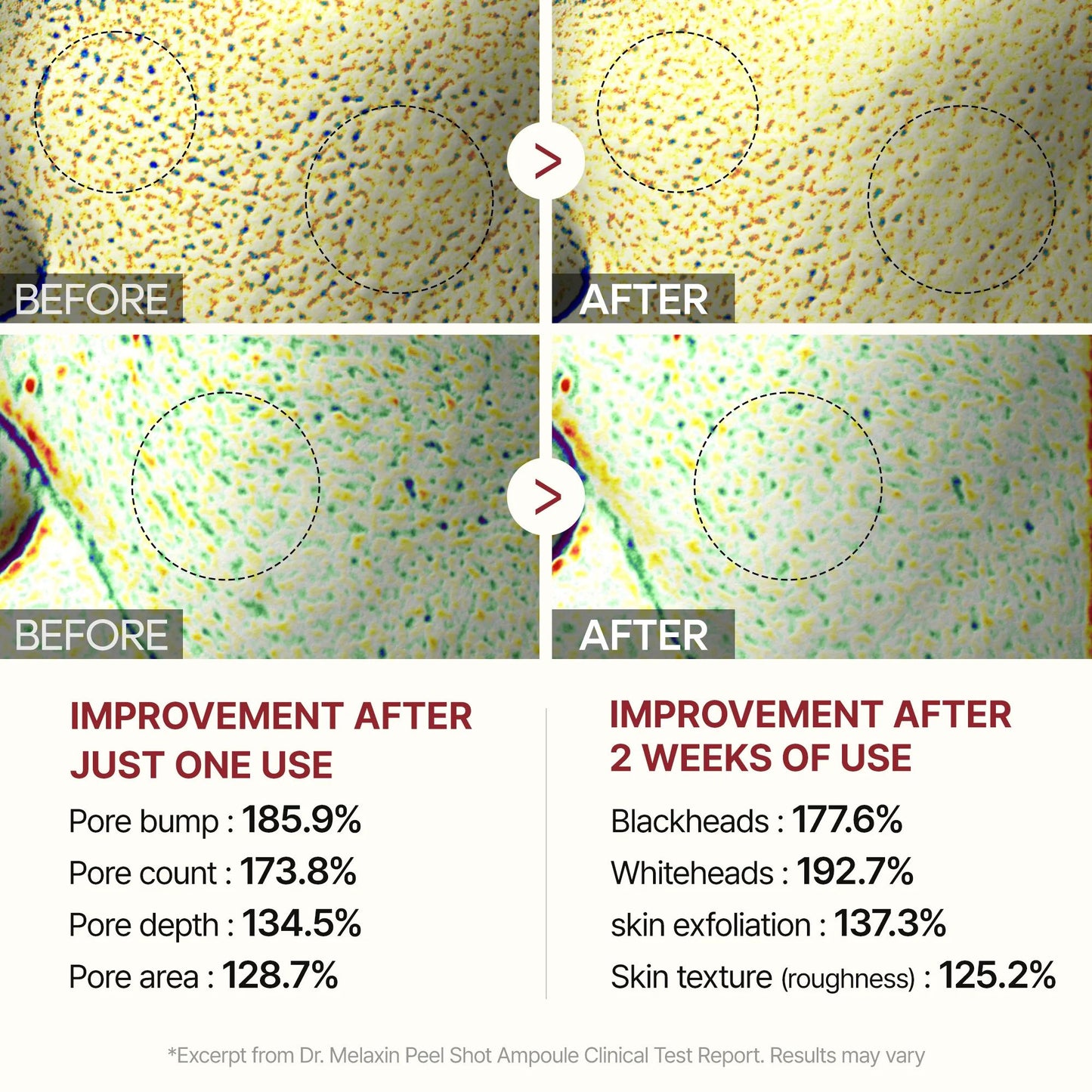 Peel Shot Glow White Rice Ampoule