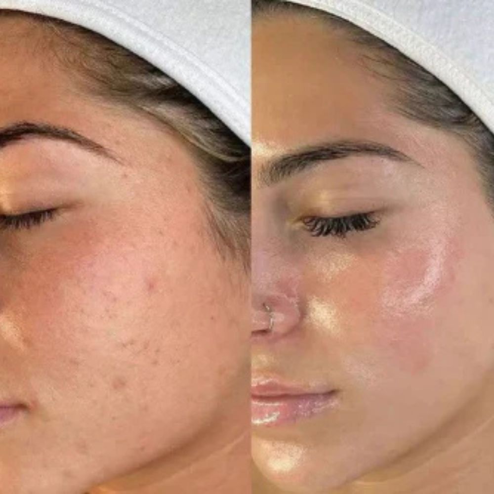 Peel Shot Glow Black Rice Ampoule